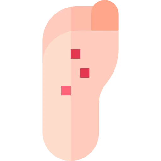 plantar-wart
