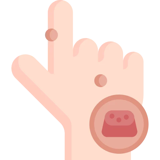 wart